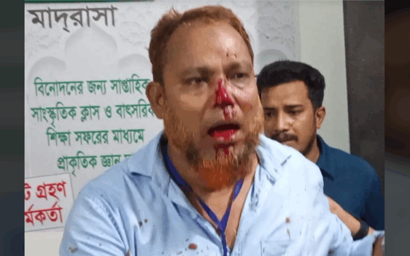 রামগঞ্জে উপজেলা বিএনপির যুগ্ম আহবায়ক আবুল কাশেমের উপর হামলা